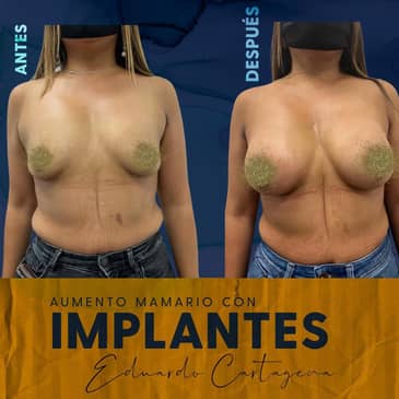 Slider image (6) Dr. Eduardo Cartagena - Plastic Surgeon in Mexico City